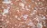 Anti Human Glucose Transporter 5 Antibody thumbnail image 1