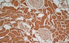 Anti Human Glucose Transporter 5 Antibody gallery image 2