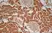 Anti Human Glucose Transporter 5 Antibody thumbnail image 2