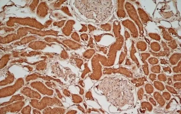Anti Human Glucose Transporter 5 Antibody gallery image 2