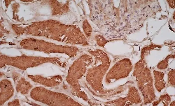Anti Human Glucose Transporter 5 Antibody gallery image 3