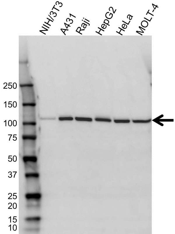 Anti Glucosidase II Alpha Antibody (PrecisionAb Polyclonal Antibody) gallery image 1