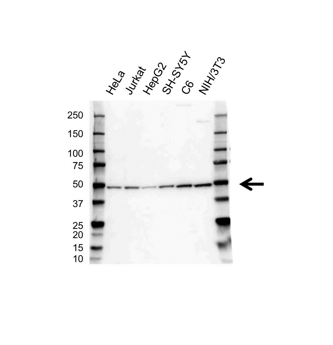 Anti GLUT-3 Antibody (PrecisionAb Polyclonal Antibody) gallery image 1