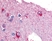 Anti Human Glycogen Phosphorylase BB Antibody thumbnail image 1