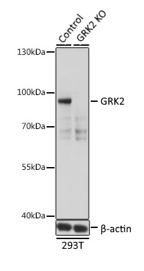Anti GRK2 Antibody gallery image 2