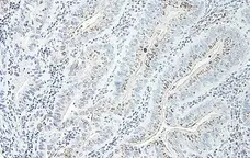 Anti Human GRO Beta Antibody gallery image 2