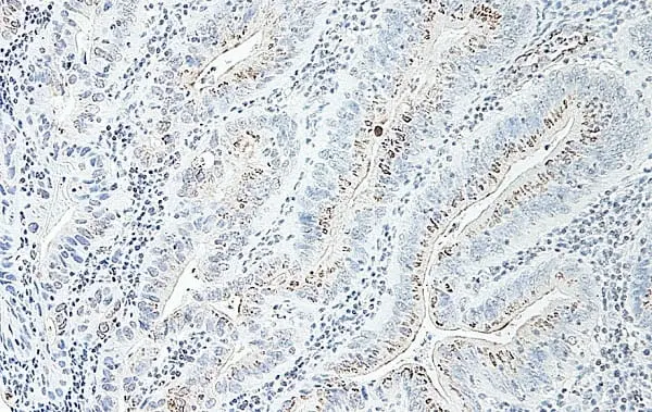 Anti Human GRO Beta Antibody gallery image 2