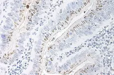 Anti Human GRO Beta Antibody gallery image 3