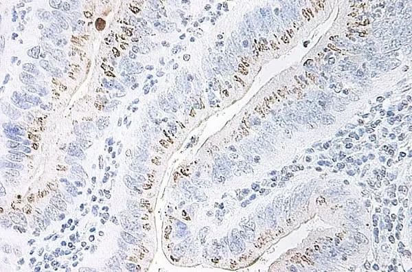 Anti Human GRO Beta Antibody gallery image 3
