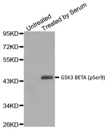 Anti Human GSK3 Beta (pSer9) Antibody gallery image 1