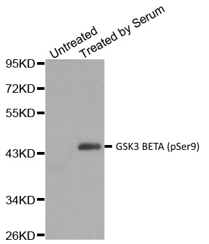 Anti Human GSK3 Beta (pSer9) Antibody gallery image 1