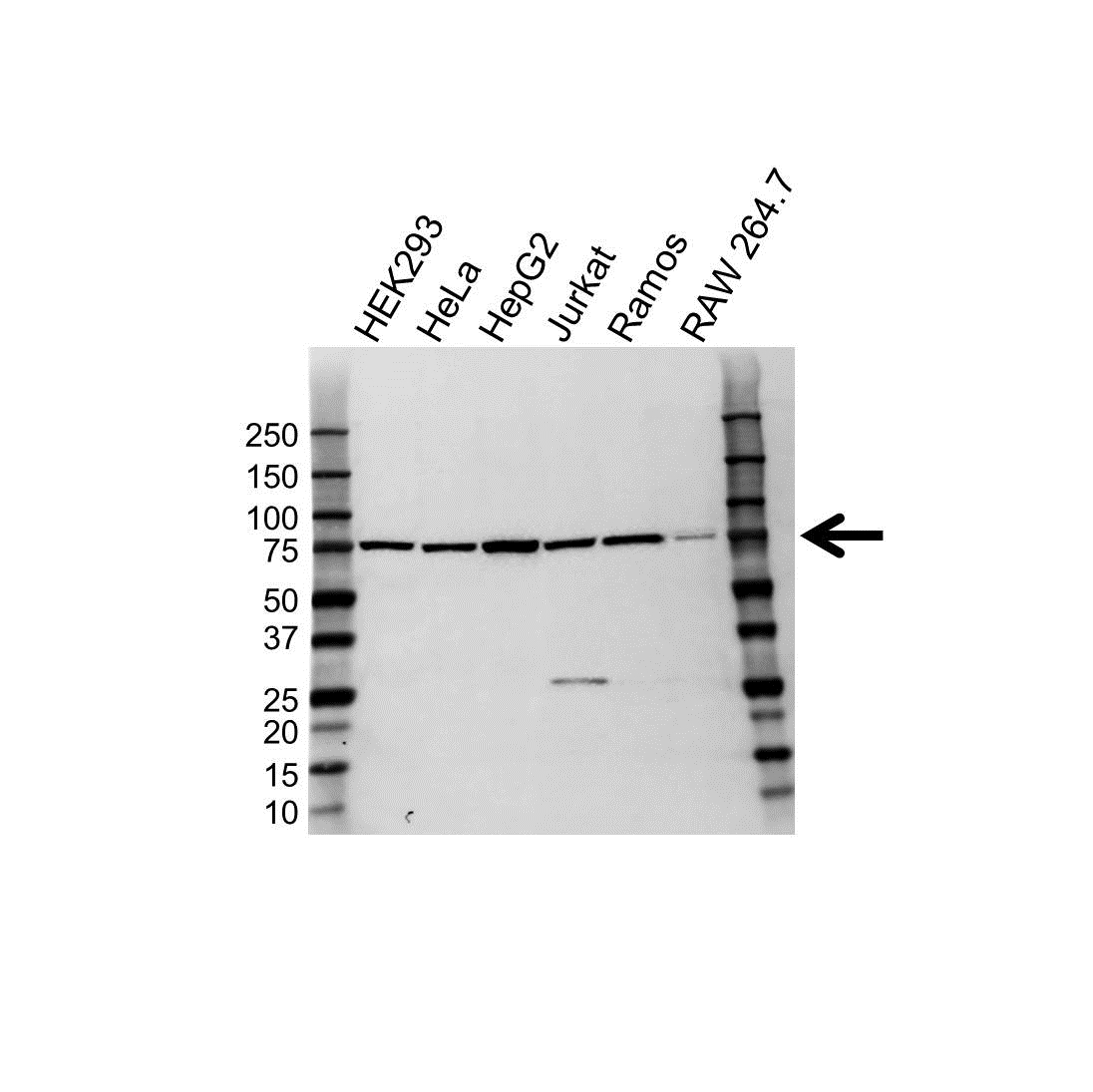 Anti Hadha Antibody (PrecisionAb Polyclonal Antibody) gallery image 1