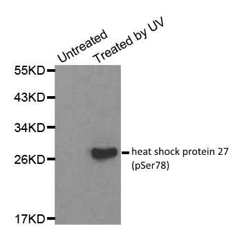 Anti Heat Shock Protein 27 (pSer78) Antibody gallery image 1