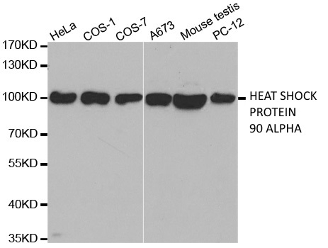 Anti Heat Shock Protein 90 Alpha Antibody gallery image 1