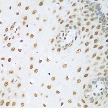 Anti Histone Deacetylase 1 Antibody gallery image 4