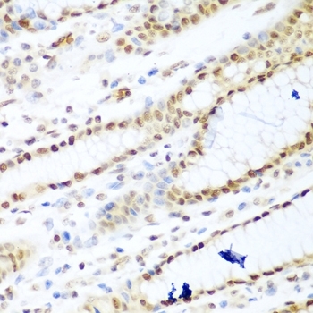 Anti Histone Deacetylase 1 Antibody gallery image 5