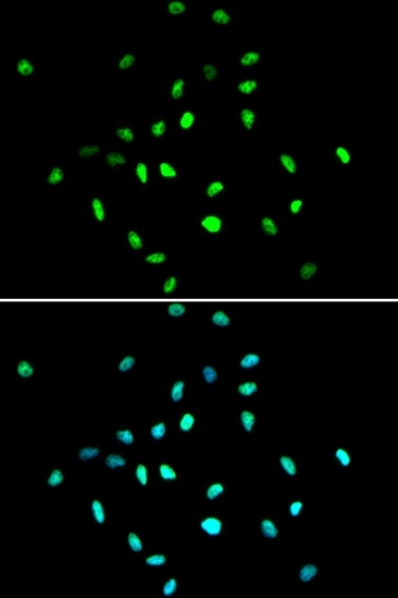 Anti Histone Deacetylase 1 Antibody gallery image 6