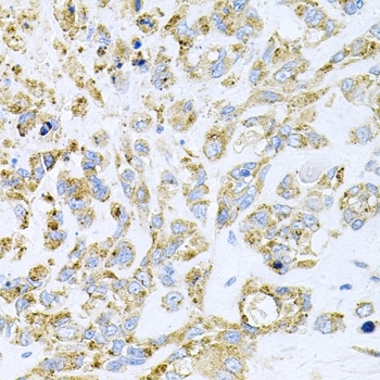 Anti Histone Deacetylase 3 Antibody gallery image 3
