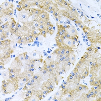 Anti Histone Deacetylase 3 Antibody gallery image 5