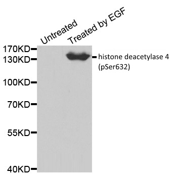 Anti Histone Deacetylase 4 (pSer632) Antibody gallery image 1