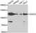 Anti Histone Deacetylase 5 Antibody thumbnail image 1