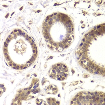 Anti Histone Deacetylase 5 Antibody gallery image 2