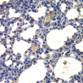 Anti Histone Deacetylase 5 Antibody gallery image 3
