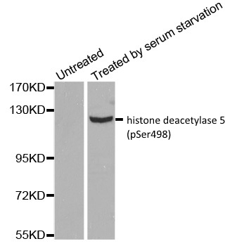 Anti Histone Deacetylase 5 (pSer498) Antibody gallery image 1