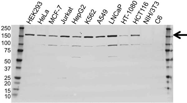 Anti Histone Deacetylase 6 Antibody (PrecisionAb Polyclonal Antibody) gallery image 1