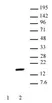 Anti Human Histone H2A (pThr120) Antibody thumbnail image 1
