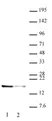 Anti Human Histone H2A.X (pTyr142) Antibody thumbnail image 1