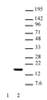 Anti Human Histone H2B (Ac15) Antibody thumbnail image 1