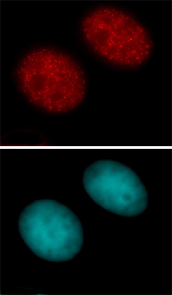 Anti Human Histone H3 (Ac27) Antibody gallery image 1