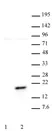 Anti Human Histone H3 (pThr11) Antibody thumbnail image 1