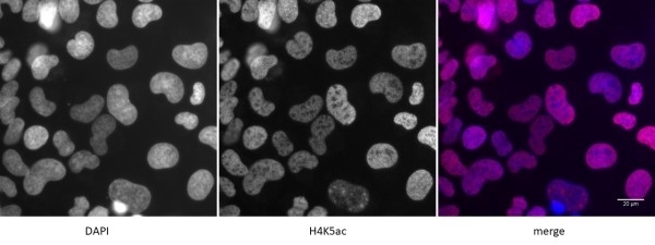 Anti Human Histone H4 (Ac5) Antibody gallery image 2