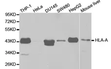 Anti HLA A Antibody gallery image 1