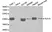 Anti HLA A Antibody thumbnail image 1