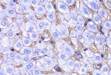 Anti HLA A Antibody gallery image 2