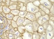 Anti HLA A Antibody gallery image 3