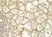Anti HLA A Antibody thumbnail image 3