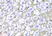 Anti HLA A Antibody thumbnail image 4