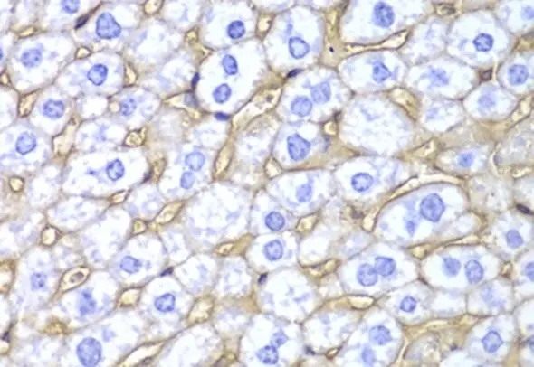 Anti HLA A Antibody gallery image 4