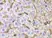 Anti HLA A Antibody thumbnail image 5
