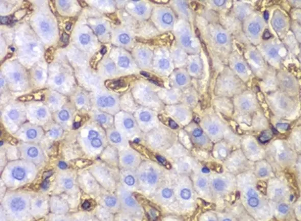 Anti HLA A Antibody gallery image 5