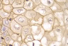 Anti HLA A Antibody gallery image 6