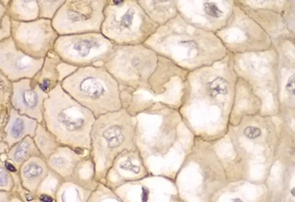 Anti HLA A Antibody gallery image 6
