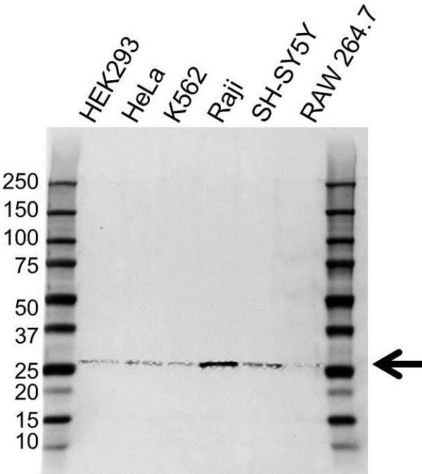 Anti HLA-DQA2 Antibody (PrecisionAb Polyclonal Antibody) gallery image 1