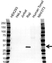 Anti HLA DRB4 Antibody (PrecisionAb Polyclonal Antibody) thumbnail image 1