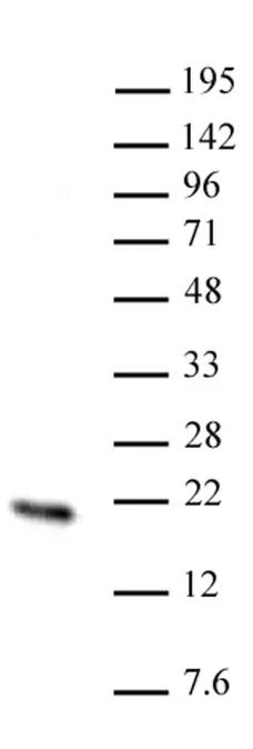 Anti Human HMGN2 Antibody gallery image 1