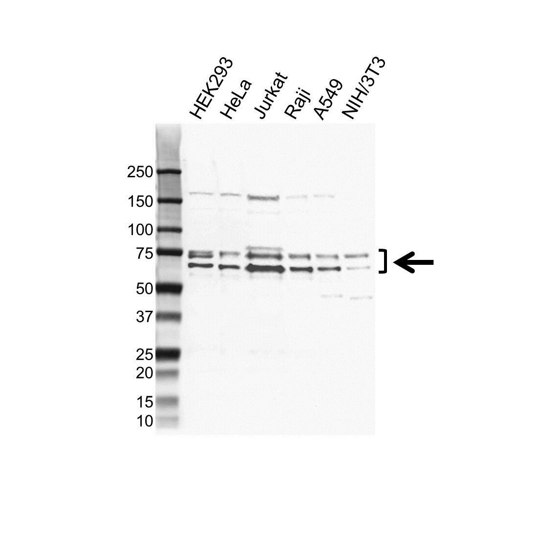 Anti hnRNP K Antibody (PrecisionAb Polyclonal Antibody) gallery image 1